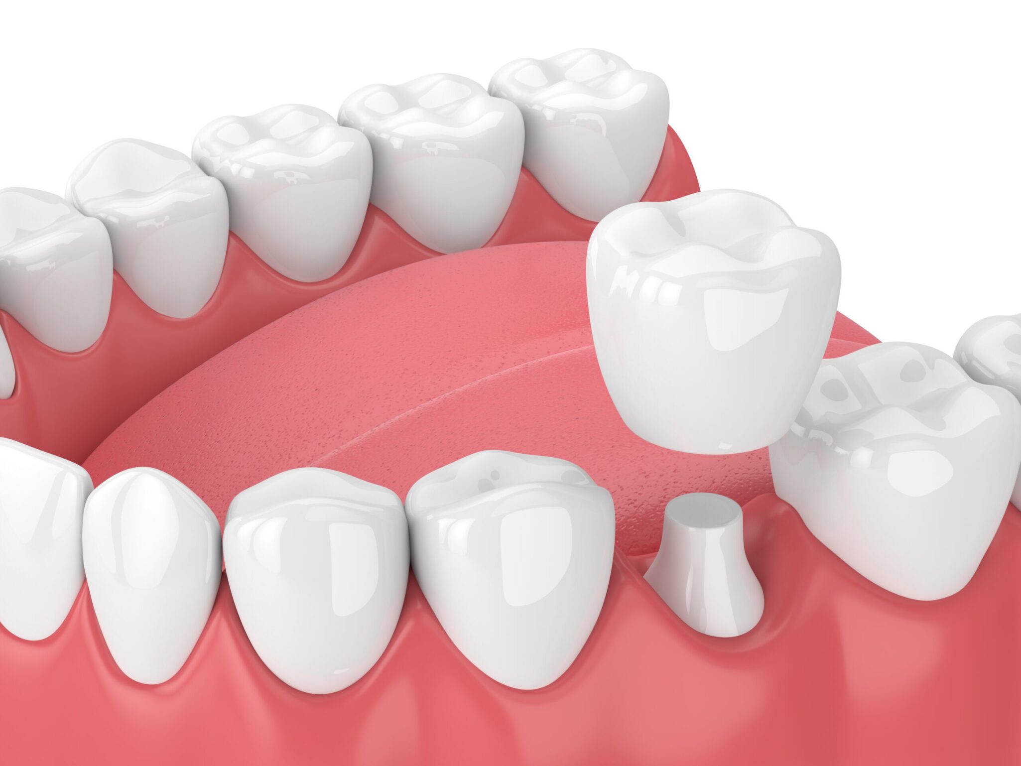 Premier Arts Dental -